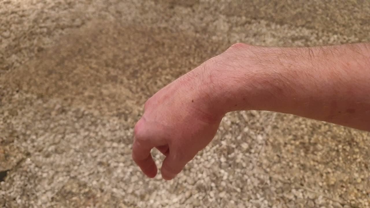 February 15, 2019 — day 239. The first thing that wrist had done on its own in eight months. A hand in wrist drop lifting slightly for the first time